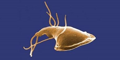 Aarte vu Parasiten am mënschleche Kierper