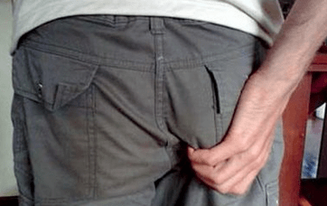 Jucken am Anus als Symptom vun der Präsenz vu Parasiten