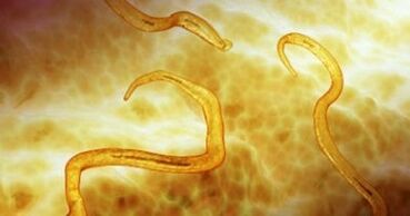 Pinworm Parasiten am mënschleche Kierper