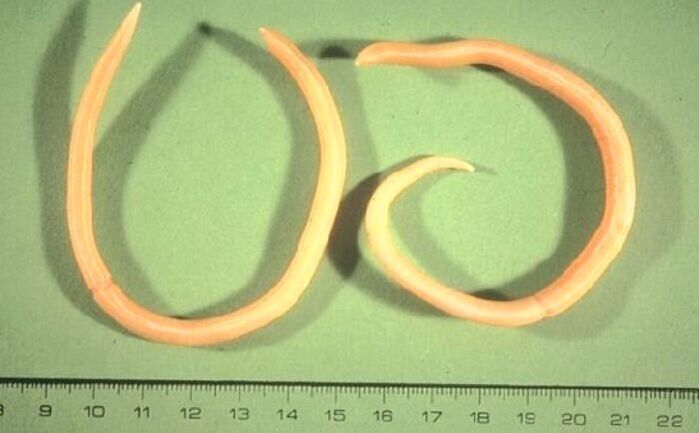 Pinworm aus dem mënschleche Kierper