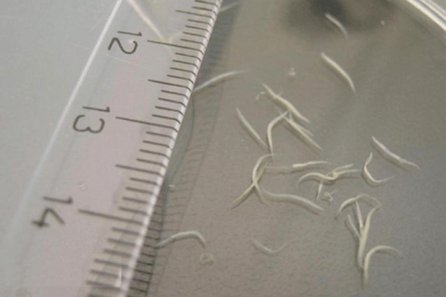 wéi Pinworms aus engem Kand ewechzehuelen