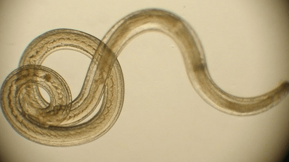 Wurmparasit aus dem mënschleche Kierper
