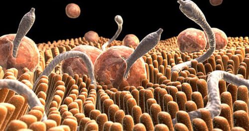Parasiten am mënschleche Kierper