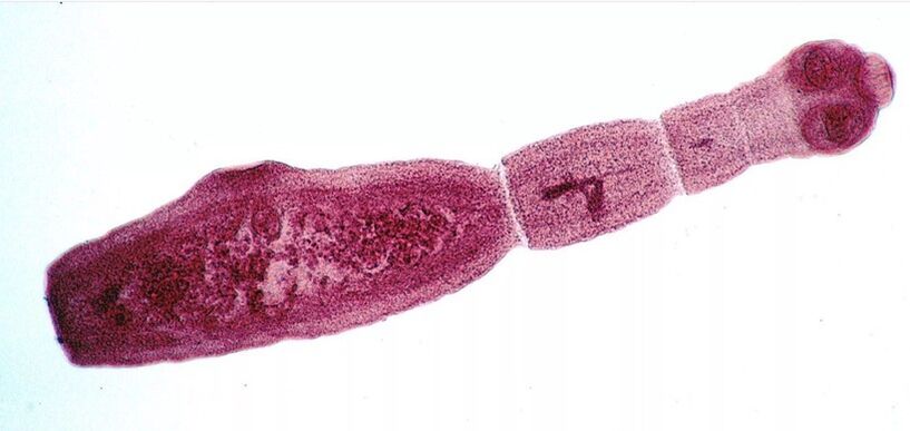 Echinococcus ass ee vun de geféierlechste Parasiten fir Mënschen