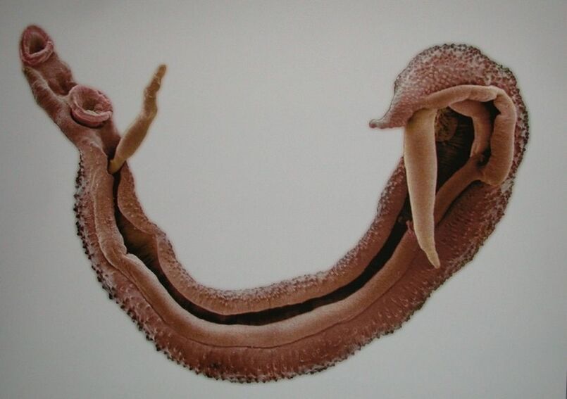 Schistosome sinn e geféierleche Parasit am mënschleche Blutt