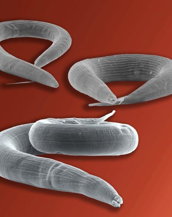 Pinworm Parasit am Darm lieft