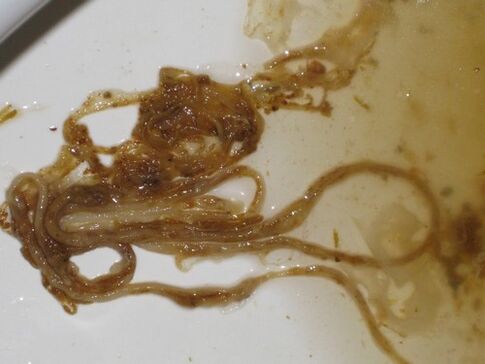 Würmer Parasiten aus dem mënschleche Kierper