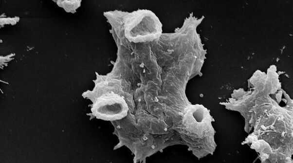 Negleria fowlera ass e protozoan Parasit geféierlech fir mënschlecht Liewen. 