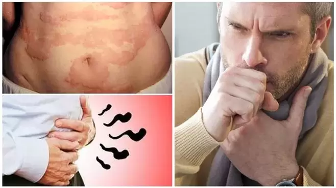 Allergien, Husten an Blähungen sinn Unzeeche vu Schied un de Kierper duerch Würmer